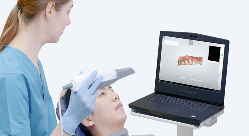 Scanner 3D intra-oral.